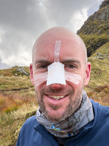 DIY field repair on my burst nose
